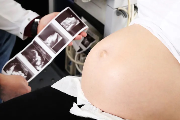 12 поширених питань про УЗД для вагітних